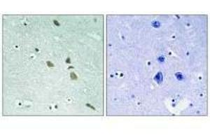 Immunohistochemistry analysis of paraffin-embedded human brain tissue using ILK (Ab-246) antibody.