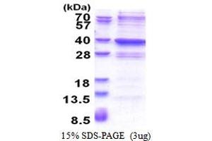 SDS-PAGE (SDS) image for Glycine-N-Acyltransferase-Like 2 (GLYATL2) (AA 1-294) protein (His tag) (ABIN5853534)