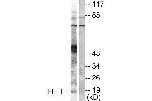 Western blot analysis of extracts from A549 cells, using FHIT antibody (#C0193). (FHIT anticorps)