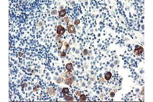 Immunohistochemistry (IHC) image for anti-Dipeptidylpeptidase 10 (DPP10) antibody (ABIN1497834) (DPP10 anticorps)
