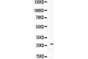 Western blot analysis of CNTF expression in MCF-7 whole cell lysates (lane 1). (CNTF anticorps  (AA 12-200))