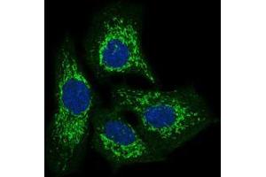 Immunofluorescence analysis of HeLa cells using TWF1 mouse mAb (green).