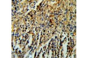 Immunohistochemistry analysis in human spleen tissue (Formalin-fixed, Paraffin-embedded) using PHTNS  Antibody  (N-term), followed by peroxidase conjugation of the secondary antibody and DAB staining.