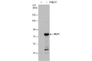 WB Image MLH1 antibody detects MLH1 protein by western blot analysis. (MLH1 anticorps)