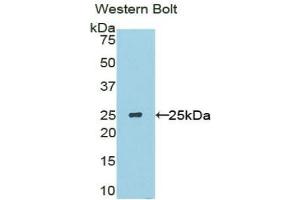 Western blot analysis of the recombinant protein. (SOSTDC1 anticorps  (AA 24-206))