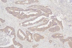IHC analysis of SEMA3B using anti-SEMA3B antibody (ABIN6719617).