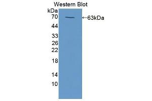 Western blot analysis of the recombinant protein. (HCK anticorps  (AA 2-526))