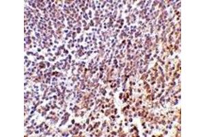 Immunohistochemistry (IHC) image for anti-Lymphocyte Antigen 86 (LY86) (C-Term) antibody (ABIN1030512) (LY86 anticorps  (C-Term))