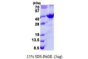 Figure annotation denotes ug of protein loaded and % gel used. (FRZB Protéine)