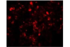 Immunofluorescence of Translin in human lung tissue with Translin antibody at 20 µg/ml.