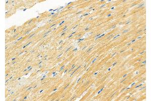 ABIN6263312 and ABIN6266806 at 1/100 staining Rat heart tissue by IHC-P. (Meningioma 1 anticorps  (Internal Region))