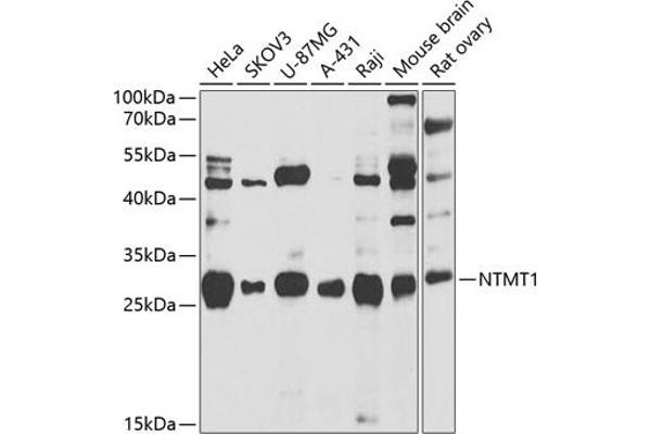METTL11A antibody  (AA 1-223)