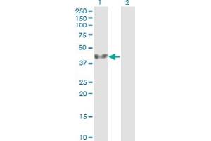 Western Blot analysis of ADRM1 expression in transfected 293T cell line by ADRM1 monoclonal antibody (M01), clone 3C6. (ADRM1 anticorps  (AA 18-407))
