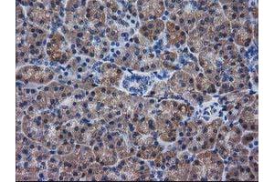 Immunohistochemical staining of paraffin-embedded Human pancreas tissue using anti-DSTN mouse monoclonal antibody. (Destrin anticorps)