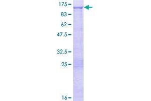 Image no. 1 for Tumor Protein P63 (TP63) (AA 1-680) protein (GST tag) (ABIN1323400)