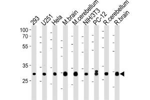 Western Blotting (WB) image for anti-Phosphatidylinositol Transfer Protein, alpha (PITPNA) antibody (ABIN3004594) (PITPNA anticorps)