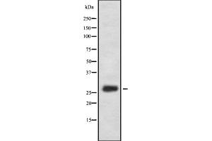 Western blot analysis of FA58A expression in HEK293 cells ,The lane on the left is treated with the antigen-specific peptide. (FAM58A anticorps  (Internal Region))