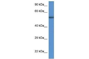 Western Blot showing GBA antibody used at a concentration of 1 ug/ml against MDA-MB-435S Cell Lysate