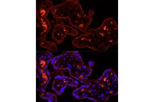 Immunofluorescence analysis of human placenta using CYP11 Rabbit pAb (713) at dilution of 1:100 (40x lens).