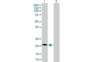 Western Blot analysis of MCAT expression in transfected 293T cell line by MCAT MaxPab polyclonal antibody. (MCAT anticorps  (AA 1-180))