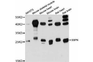 Western blot analysis of extracts of various cell lines, using SSPN antibody (ABIN6293742) at 1:3000 dilution. (SSPN anticorps)
