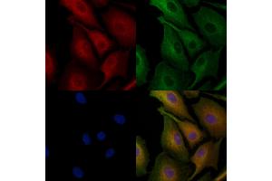 ABIN6259672 and ABIN6278181 staining  cells by IF/ICC. (ABAT anticorps  (Internal Region))