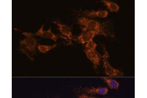 Immunofluorescence analysis of C6 cells using PYCR2 Polyclonal Antibody at dilution of 1:100. (PYCR2 anticorps)