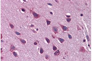 Human Brain, Cortex: Formalin-Fixed, Paraffin-Embedded (FFPE)