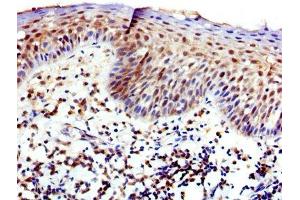 IHC image of ABIN7175826 diluted at 1:400 and staining in paraffin-embedded human tonsil tissue performed on a Leica BondTM system.