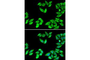 Immunofluorescence analysis of MCF-7 cells using RPS14 antibody. (RPS14 anticorps)