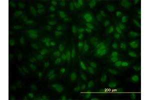 Immunofluorescence of monoclonal antibody to POGK on HeLa cell.