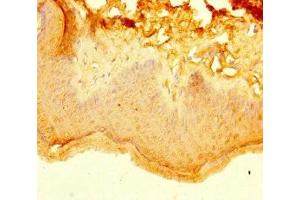 Immunohistochemistry of paraffin-embedded human skin tissue using ABIN7157404 at dilution of 1:100