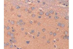 Detection of CA5B in Mouse Cerebrum Tissue using Polyclonal Antibody to Carbonic Anhydrase VB, Mitochondrial (CA5B)