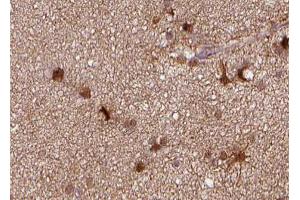ABIN6266780 at 1/100 staining human brain tissue sections by IHC-P. (TNFRSF6B anticorps)