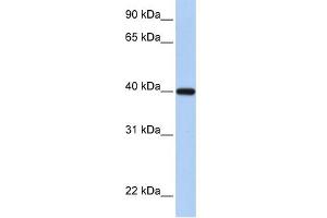 WB Suggested Anti-RDH11 Antibody Titration:  0. (RDH11 anticorps  (C-Term))
