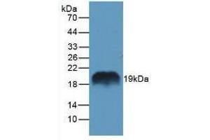 Western blot analysis of Rat Pancreas Tissue. (REG1A anticorps  (AA 10-165))