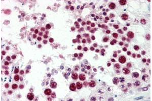 Human Testis (formalin-fixed, paraffin-embedded) stained with EZH2 antibody ABIN337251 at 5 ug/ml followed by biotinylated goat anti-rabbit IgG secondary antibody ABIN481713, alkaline phosphatase-streptavidin and chromogen. (EZH2 anticorps  (Internal Region))