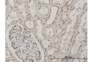 Immunoperoxidase of monoclonal antibody to MSI1 on formalin-fixed paraffin-embedded human kidney. (MSI1 anticorps  (AA 1-87))