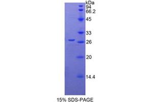 SDS-PAGE analysis of Mouse CYR61 Protein. (CYR61 Protéine)