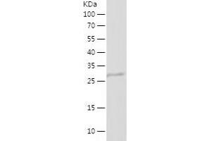 Western Blotting (WB) image for Angiogenin (ANG) (AA 25-147) protein (His-IF2DI Tag) (ABIN7125475)