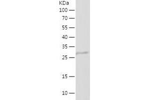 Western Blotting (WB) image for Angiogenin (ANG) (AA 25-147) protein (His-IF2DI Tag) (ABIN7125475) (ANG Protein (AA 25-147) (His-IF2DI Tag))