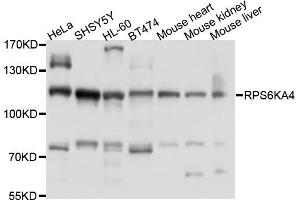 Western blot analysis of extracts of various cell lines, using RPS6KA4 antibody (ABIN6003828) at 1/1000 dilution. (MSK2 anticorps)