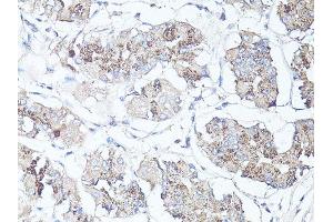 Immunohistochemistry of paraffin-embedded human stomach using MAP1LC3B antibody. (LC3B anticorps)