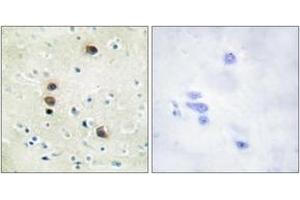 Immunohistochemistry analysis of paraffin-embedded human brain, using PKD1/PKC mu (Phospho-Ser205) Antibody.