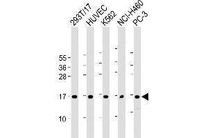 All lanes : Anti-CCL26 Antibody (C-Term) at 1:2000 dilution Lane 1: 293T/17 whole cell lysate Lane 2: HUVEC whole cell lysate Lane 3: K562 whole cell lysate Lane 4: NCI- whole cell lysate Lane 5: PC-3 whole cell lysate Lysates/proteins at 20 μg per lane. (CCL26 anticorps  (AA 58-92))