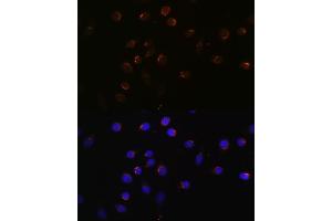 Immunofluorescence analysis of L929 cells using CUX1 antibody (ABIN1679438, ABIN3015866, ABIN3015867 and ABIN6219446) at dilution of 1:100.