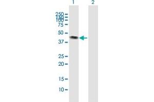 Western Blot analysis of CALR3 expression in transfected 293T cell line by CALR3 MaxPab polyclonal antibody. (Calreticulin 3 anticorps  (AA 1-384))