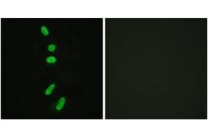 Immunofluorescence analysis of HeLa cells, using SF1 (Ab-82) Antibody. (Splicing Factor 1 anticorps  (AA 48-97))