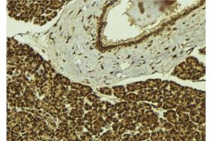 ABIN6279403 at 1/100 staining Mouse pancreas tissue by IHC-P. (UBR2 anticorps  (C-Term))