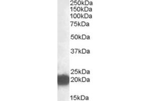Image no. 1 for anti-Cysteine and Glycine-Rich Protein 3 (CSRP3) (Internal Region) antibody (ABIN375064) (CSRP3 anticorps  (Internal Region))